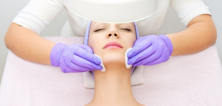 Kimyasal soyma nedir? 